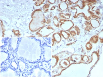 IHC staining of FFPE human thyroid tissue with Calcitonin antibody (clone CALCA/8639R). Inset: PBS u