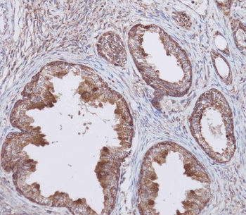 IHC testing of FFPE human prostate tissue with WFDC1 antibody. HIER: steam section in pH9 EDTA for 2