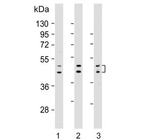 Western blot testing of human 1) HepG2, 2) LNCaP and 3) MDA-MB-453 cell lysate with UGT2B4 antibody.