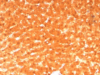 GCHFR Antibody / GFRP