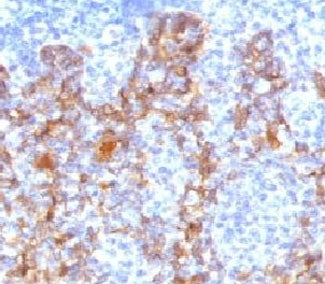 IHC testing of FFPE human tonsil with Acidic Cytokeratin antibody.