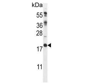 Western blot testing of mouse heart tissue lysate with Calcipressin-2 antibody. Predicted molecular 