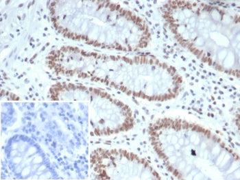 IHC staining of FFPE human colon tissue with MutL Homolog 1 antibody (clone MLH1/7562). HIER: boil t