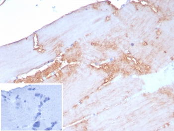 IHC staining of FFPE human skeletal muscle tissue with ACTN2 antibody (clone rACTN2/8177). Inset: PB