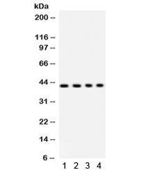 Western blot testing of 1) rat liver, 2) human HeLa, 3) SW620 and 4) mouse HEPA lysate with PARVA an
