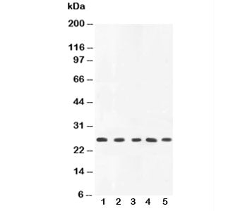 Western blot testing of TNFa antibody and rat samples: 1. PC-12, 2. spleen, 3. brain, 4. kidney, 5. 
