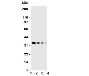 Western blot testing of GCN2 antbody; Lane 1: Recombinant mouse protein 10ng; 2: 5ng; 3: 2.5ng; 4: 1