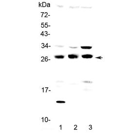 Western blot testing of 1) human SGC-7901, 2) rat testis and 3) mouse testis lysate with TPMT antibo
