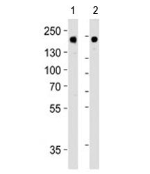 HER-2 Antibody