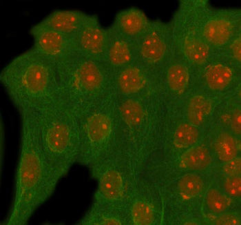 Immunofluorescent staining of RAD54L2 using anti-RAD54L2 antibody (red) and anti-Beta Tubulin antibo