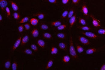 DR4 Antibody / Death Receptor 4