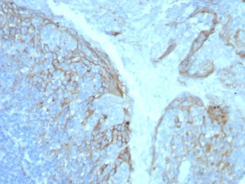 ICAM1 Antibody / CD54