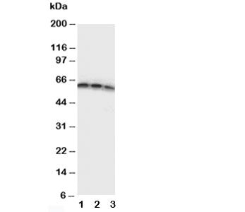 Western blot testing of CD40 antibody and Lane 1: Recombinant human protein 10ng; 2: 5ng; 3: 2.5ng