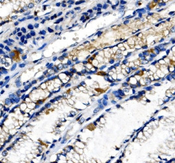 Ghrelin Antibody / GHRL