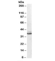 Western blot testing of human liver lysate with AKR1C4 antibody at 0.1ug/ml. Predicted molecular wei