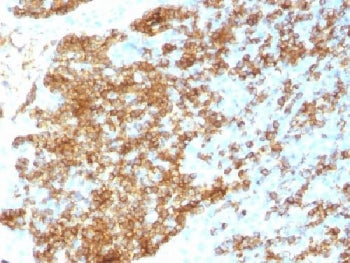 IHC testing of recombinant CD45RB antibody and FFPE human tonsil (clone PTPRC/1783R). Required HIER: