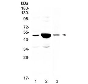 Western blot testing of 1) rat small intestine, 2) rat kidney and 3) mouse kidney lysate with Pai-1 