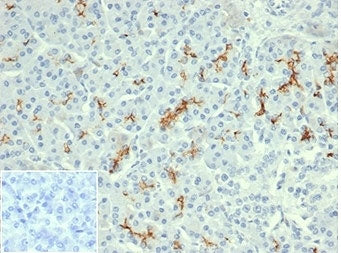 CFTR Antibody / Cystic Fibrosis Transmembrane Regulator