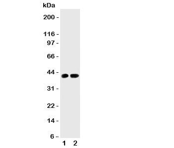 Western blot testing of Cdk6 antibody and Lane 1: rat testis; 2: (r) lung tissue lysate. Predicted m