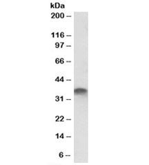 Western blot testing of placenta lysate with STX11 antibody at 1ug/ml. Predicted molecular weight: ~