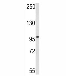 Western blot analysis of DDX58 in human 293 lysate. Expected molecular weight: 106-115 kDa.