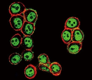 Confocal immunofluorescent analysis of phospho-SMAD3 antibody with HeLa cells followed by Alexa Fluo