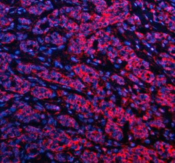 Immunofluorescent staining of GSTK1 using anti-GSTK1 antibody (red). GSTK1 was detected in a paraffi