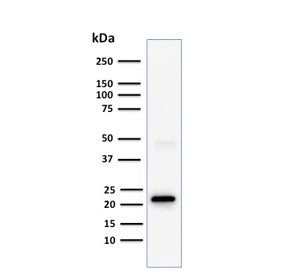 Western blot testing of human Jurkat cell lysate with CD3e antibody (clone C3e/1308). Predicted mole