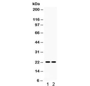 Western blot testing of 1) rat spleen and 2) rat lung lysate with Lipocalin 2 antibody. Predicted/ob