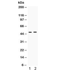 Western blot testing of human 1) HeLa and 2) A549 cell lysate with ING1 antibody. Expected/observed 