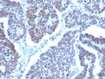 LDB2 Antibody / LIM domain binding 2