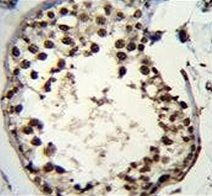 ASXL1 Antibody