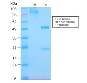 SDS-PAGE analysis of purified, BSA-free recombinant EGF Receptor antibody (clone GFR/2968R) as confi