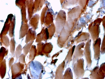 IHC staining of FFPE human cardiac muscle tissue with Sarcomeric Alpha Actinin antibody (clone ACTN2