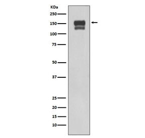 Western blot testing of human 293T cell lysate with Integrin beta 1 antibody. Expected molecular wei