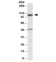 Western blot testing of human cerebellum lysate with COG1 antibody at 0.1ug/ml. The expected ~110kDa