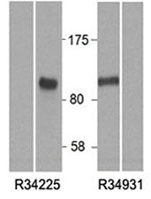 Western blot of HEK293 lysate overexpressing human HIC1 tested with HIC1 antibody at (0.5ug/ml). Moc