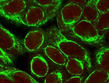 Immunofluorescent staining of permeabilized human HeLa cells with Cytokeratin 8 antibody (clone CYKN