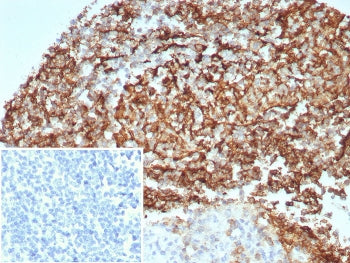 IHC staining of FFPE human kidney tissue with CD35 antibody (clone CD35/8674R) at 2ug/ml. Inset: PBS