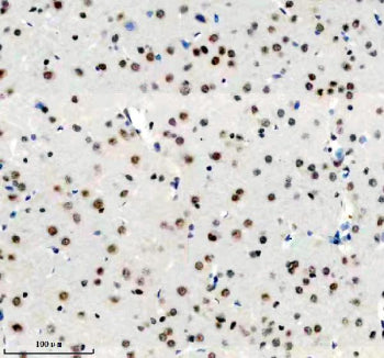 DDX17 Antibody / DEAD-box helicase 17, 100ul