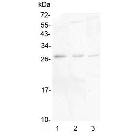 Western blot testing of 1) human placenta, 2) rat brain and 3) mouse brain lysate with IL-34 antibod