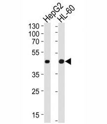 Western blot analysis of lysate from HepG2, HL-60 cell line (left to right) using beta-Actin antibody at 1:1000 for each lane.