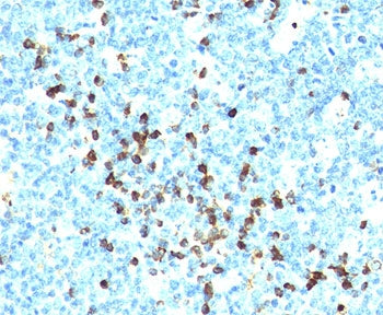 Lambda Light Chain Antibody Cocktail