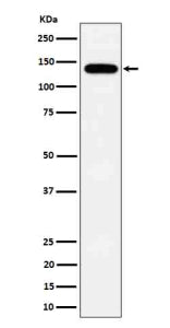 Western blot analysis of Tripeptidyl peptidase II expression in HepG2 cell lysate using TPP2 antibod