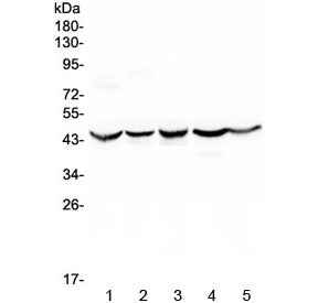 Western blot testing of human 1) HeLa, 2) placenta, 3) HepG2, 4) 22RV1 and 5) U-2 OS cell lysate wit