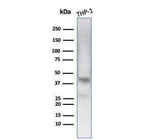 Western blot testing of human THP-1 cell lysate with Wilms Tumor 1 antibody (clone WT1/7451). Expect