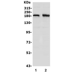 Western blot testing of human 1) SW620 and 2) U-87 MG lysate with hSET1 antibody. Predicted molecula
