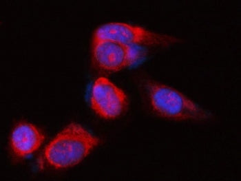 Immunofluorescent staining of FFPE human PC-3 cells with POLR1B antibody (red) and DAPI nuclear stai