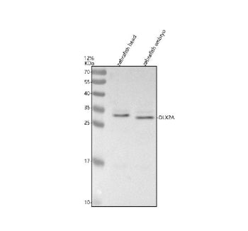 Western blot analysis of Dlx2a protein using Zebrafish Dlx2a antibody and 1) zebrafish head tissue l