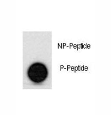 p53 Antibody (phospho-S315)
